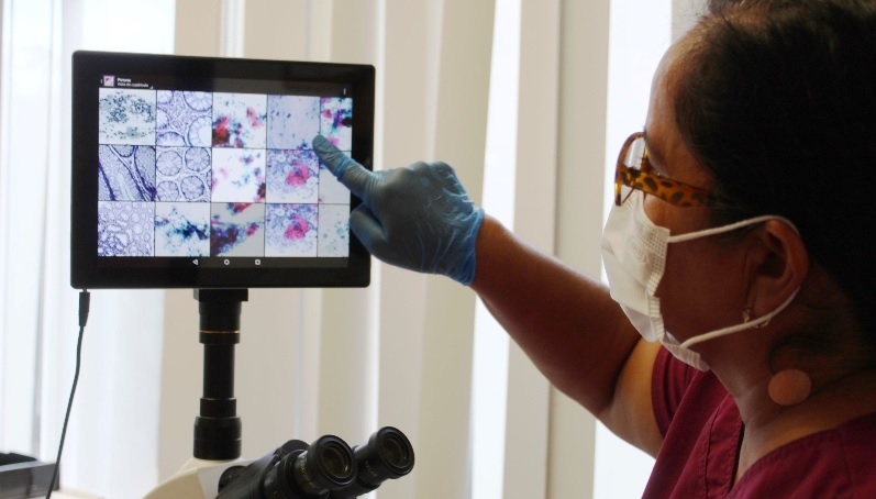 APLICA PENSIONES CIVILES MÁS DE 7 MIL 500 PRUEBAS DE PAPANICOLAU PARA DETECTAR CASOS DE CÁNCER CERVICOUTERINO