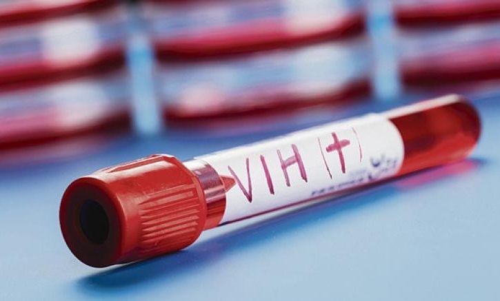 MÉXICO SUMA UNOS 370 MIL CASOS DE VIH Y, HASTA SEPTIEMBRE DE 2025