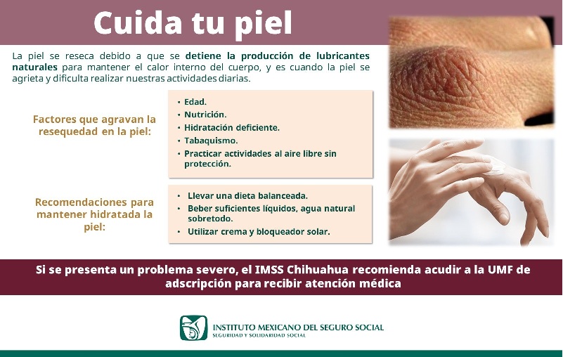 RECOMIENDA IMSS CHIHUAHUA MANTENER HUMECTADA LA PIEL EN ESTA TEMPORADA INVERNAL 
