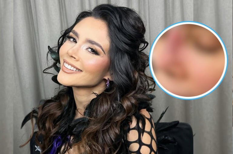 DORISMAR VUELVE AL CENTRO DE LA POLÉMICA TRAS REVELARSE IMÁGENES Y DETALLES DE LAS CIRUGÍAS ESTÉTICAS FALLIDAS 