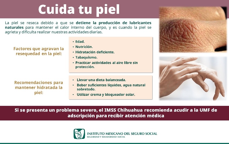 RECOMIENDA IMSS CHIHUAHUA MANTENER HUMECTADA LA PIEL EN ESTA TEMPORADA INVERNAL 