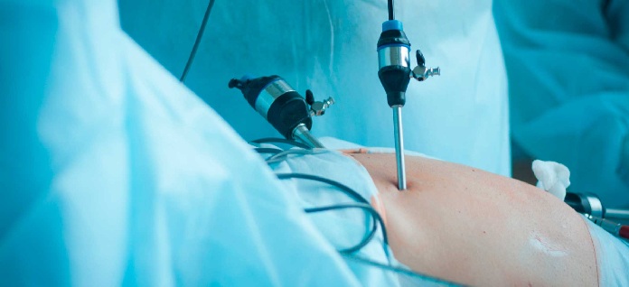 CIRUGÍA DE MÍNIMA INVASIÓN DE ÚTERO SE EMPLEA EN EL HOSPITAL DE LA MUJER