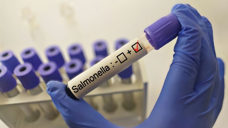 BROTE DE SALMONELLA FUE CONFIRMADO EN UN COMUNICADO POR EL HOSPITAL GENERAL DE MÉXICO 