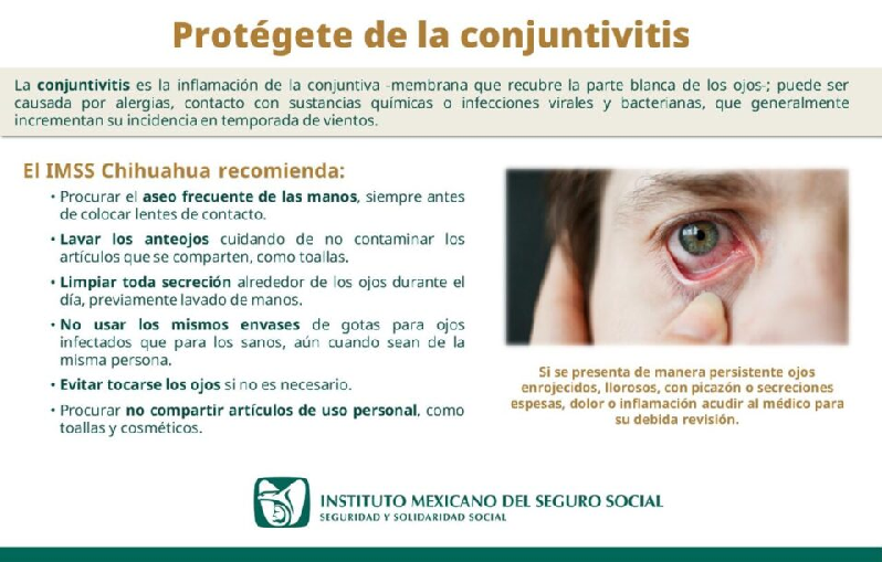LLAMA IMSS CHIHUAHUA A EXTREMAR MEDIDAS HIGIÉNICAS PARA EVITAR CONJUNTIVITIS EN ÉPOCA DE CALOR