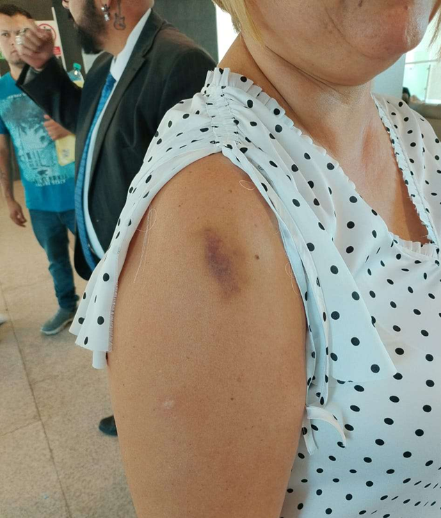 ABOGADA FUE HERIDA POR UNA   FALLA EN ELEVADOR DEL TRIBUNAL DE JUSTICIA