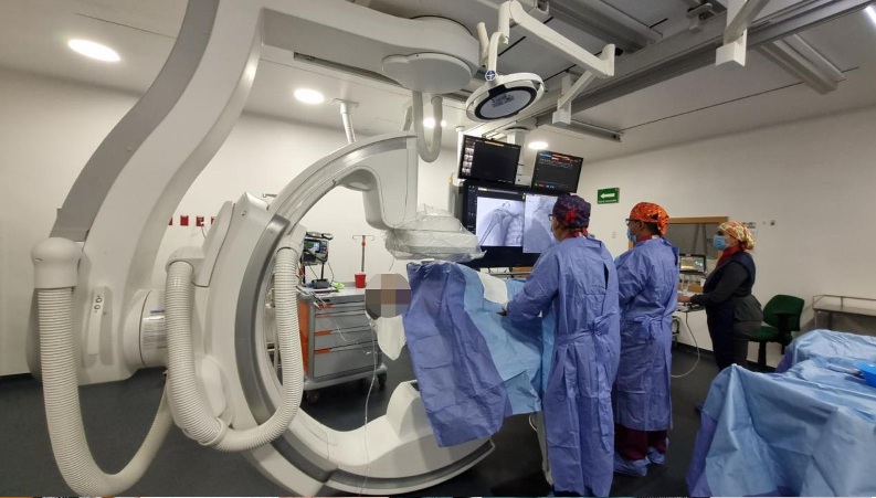 SALVA IMSS CHIHUAHUA VIDA DE PACIENTE, CON PRIMERA TROMBECTOMÍA PULMONAR ENDOVASCULAR EN EL ESTADO