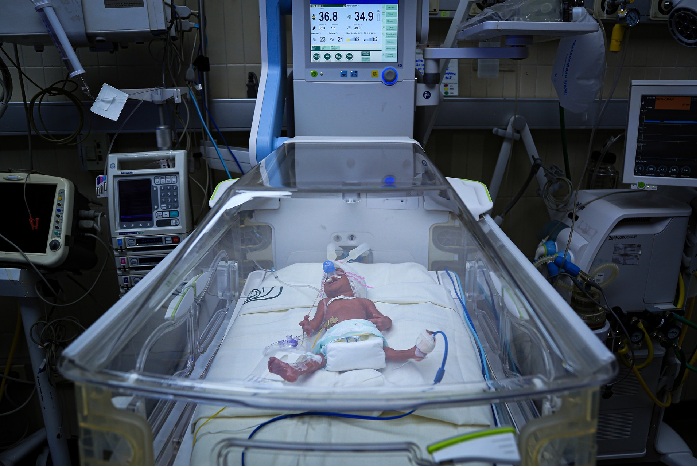 IMSS REFUERZA ATENCIÓN NEONATAL CON TECNOLOGÍA Y PROTOCOLOS ESPECIALIZADOS PARA NACIMIENTOS PREMATUROS