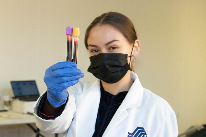 RESALTA SECRETARÍA DE SALUD LA IMPORTANCIA DE LA DETECCIÓN OPORTUNA DE LA HEMOFILIA